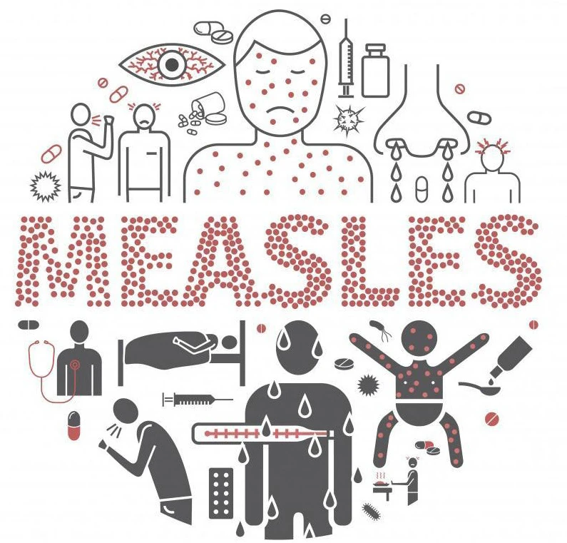 Confirmed Measles case in Boundary County